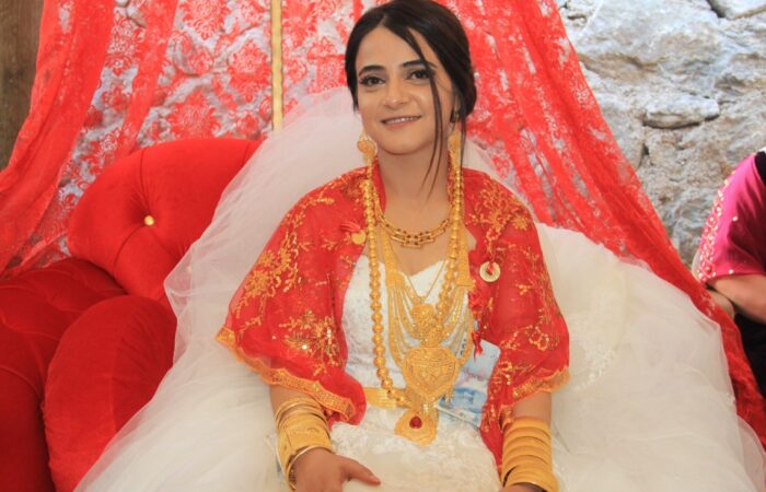 dugunde-takilan-altinlar-2