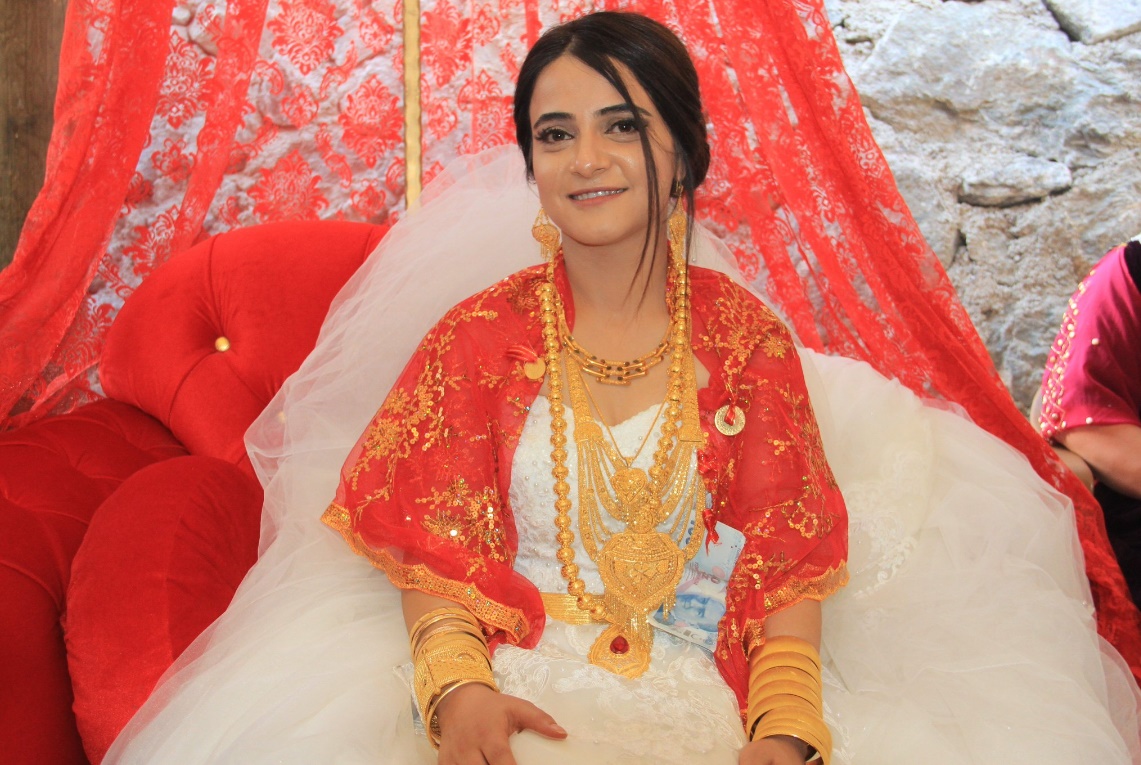 dugunde-takilan-altinlar-2